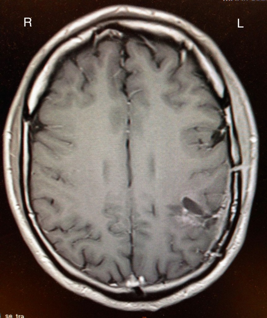 MRI brain scan 30 Oct 14 2