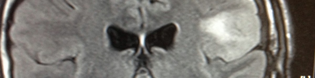 MRI Scan February 2015